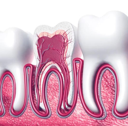 عصب کشی دندان در تهران