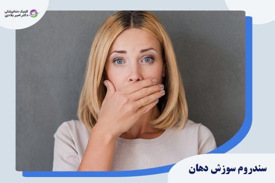 سندروم سوزش دهان