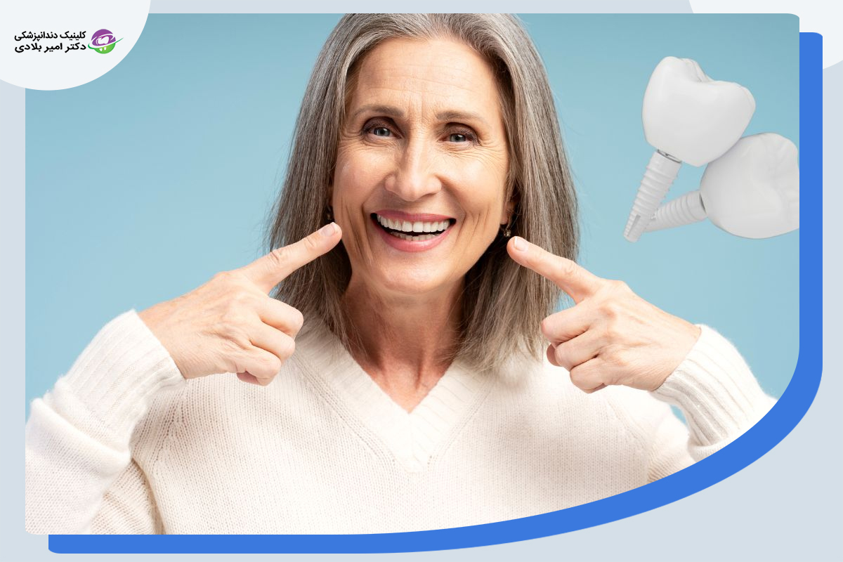 کاندیدای مناسب برای ایمپلنت بدون جراحی 