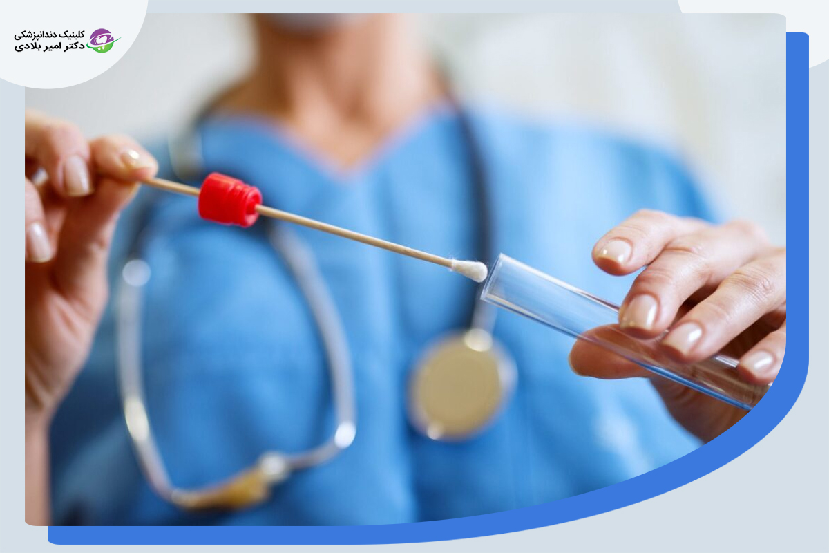 انواع آزمایش برای تشخیص سوزش دهان