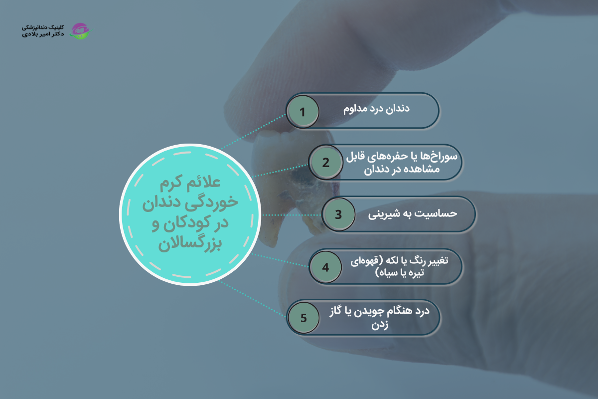علائم اولیه و پیشرفته کرم ‌خوردگی دندان در کودکان و بزرگسالان